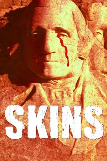 دانلود فیلم Skins 2002 دوبله فارسی بدون سانسور